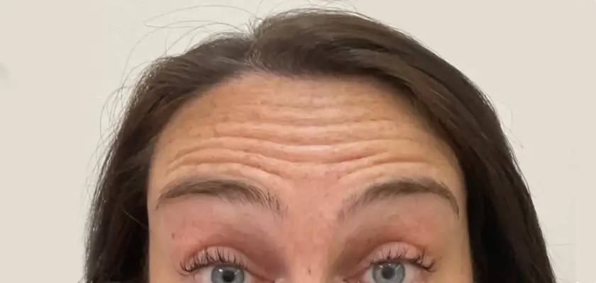 Anti-Wrinkle Before